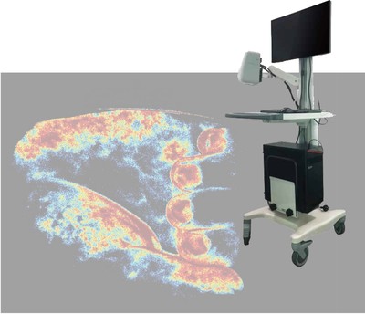 微循环动态影像系统